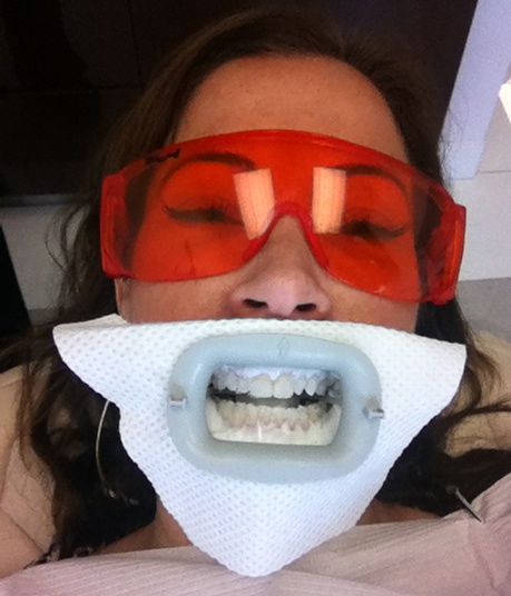 White marks on teeth after zoom whitening